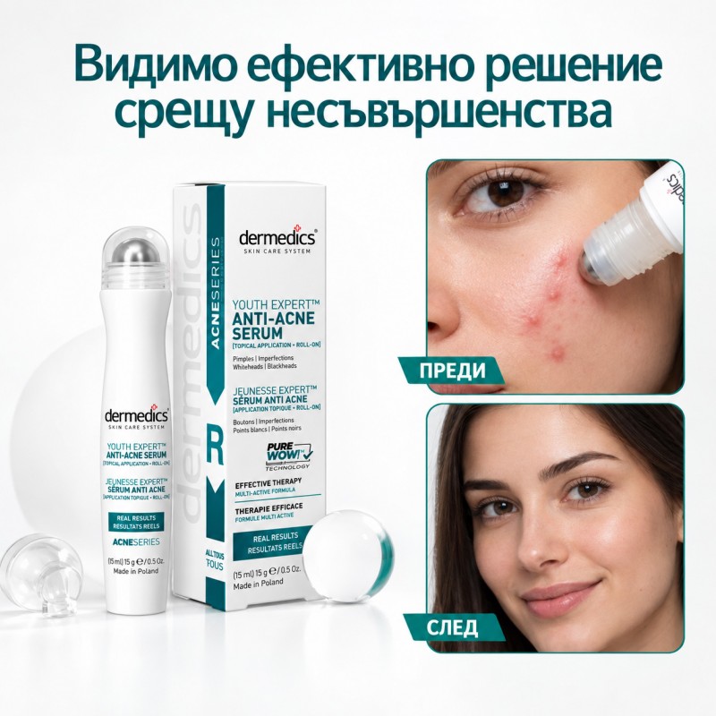 Анти-Акне ролон против акне, пъпки, разширени пори, черни точки