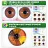 Aпарат за Ирисова диагностика