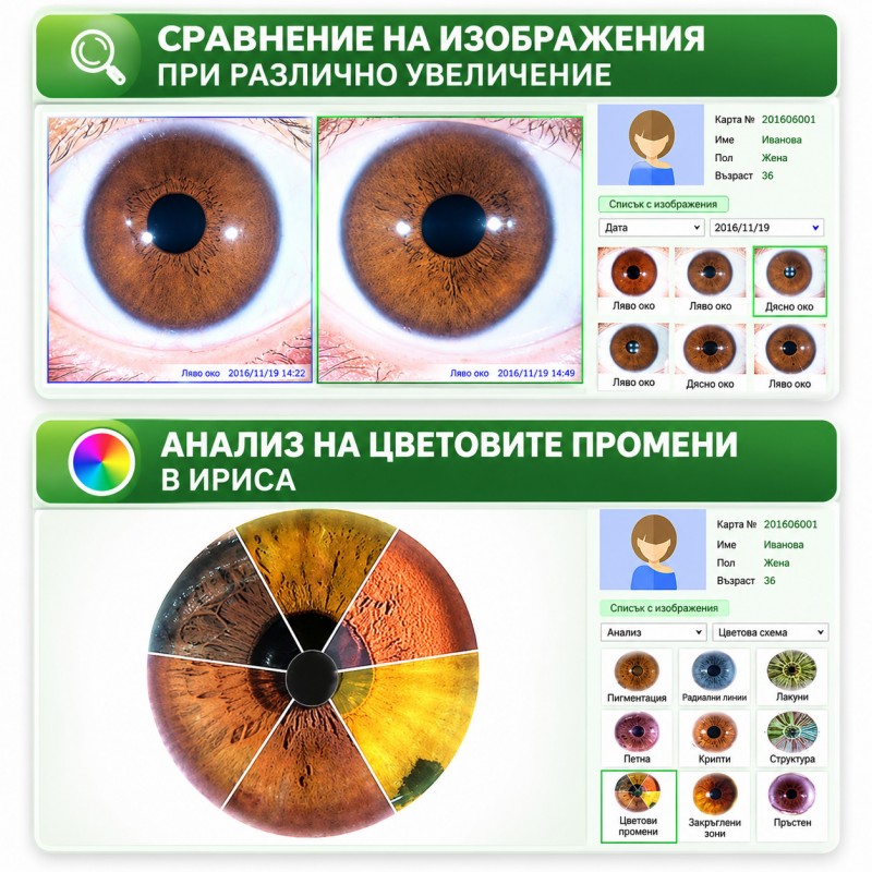 Aпарат за Ирисова диагностика
