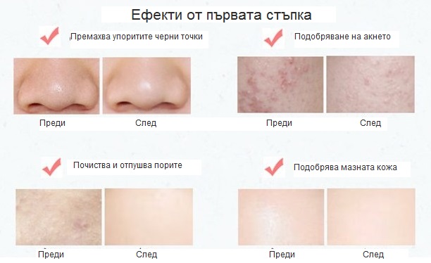 Ултразвуков пилинг с безкабелна ултразвукова шпатула