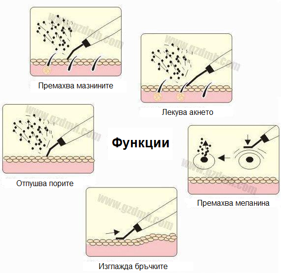 Портативна ултразвукова шпатула - безкабелна